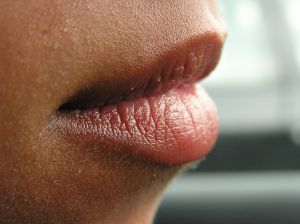 Powiększanie ust kwasem hialuronowym